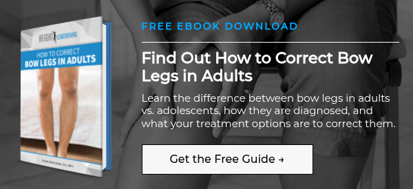 how-to-correct-bow-legs-in-adults-ebook-graphic