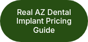 Real AZ Dental Implant Pricing Guide
