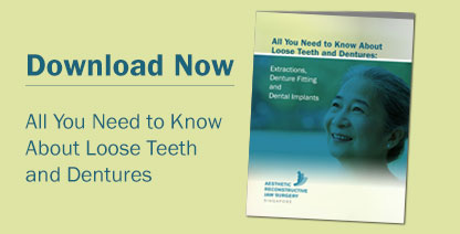 loose teeth and dentures