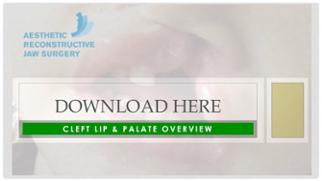 cleft lip and palate