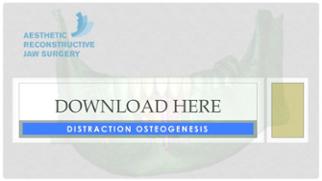 Distraction Osteogenesis