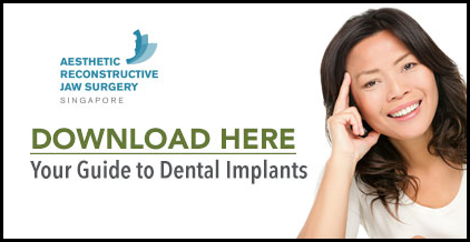 Download  Your Guide to Dental Implants ➤