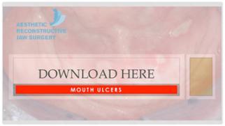 Mouth ulcers