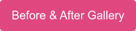 Before & After Gallery