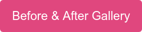 Before & After Gallery