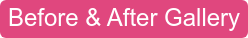 Before & After Gallery